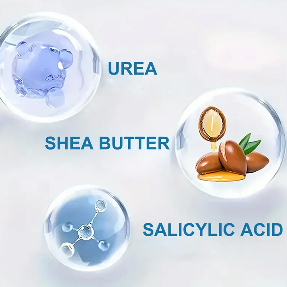 YOUNGCOME 250G Urea Cream with - огляд і ціна Azelaic Acid Cream