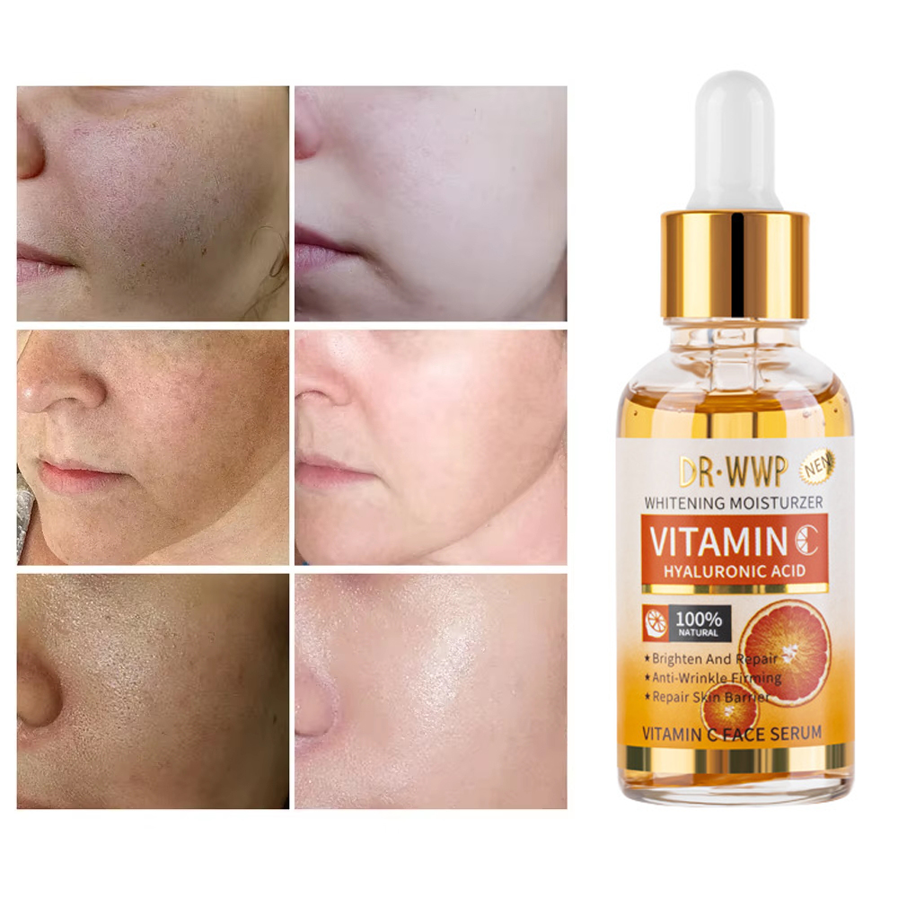 Disaar Vitamin C 30ml Face Ser - огляд і ціна Skincare Garnier