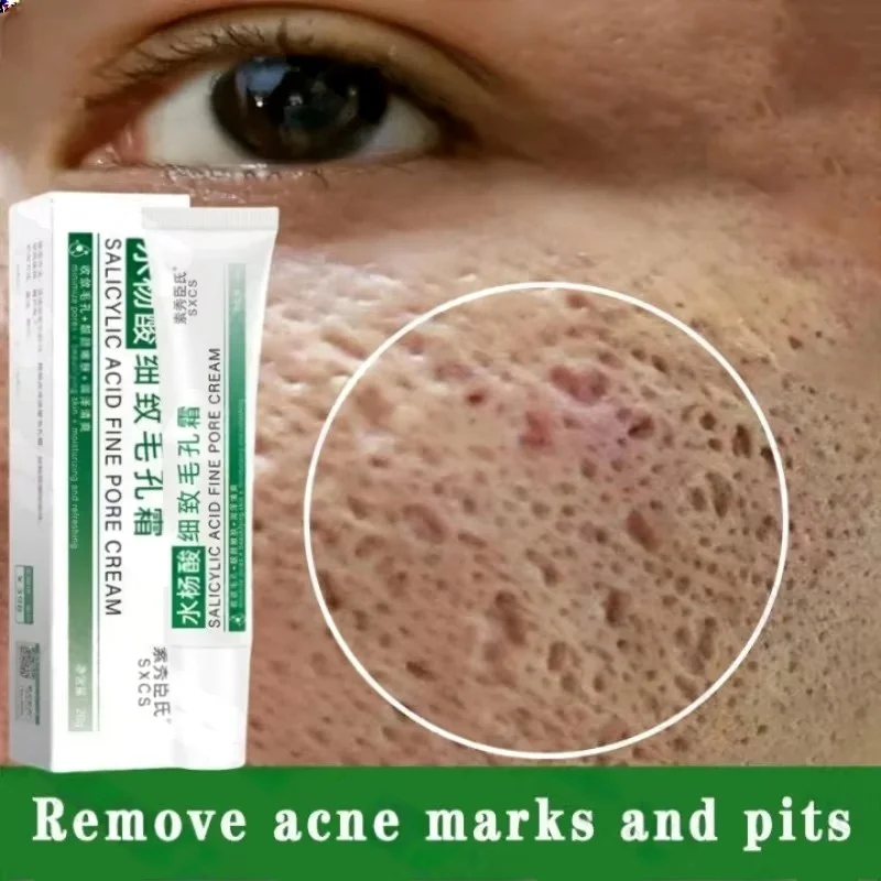 Salicylic Acid Pore Clearing C - огляд і ціна Azelaic Acid Cream