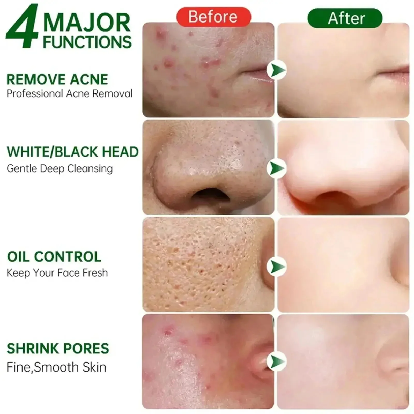 Salicylic Acid Pore Clearing C - огляд і ціна Azelaic Acid Cream