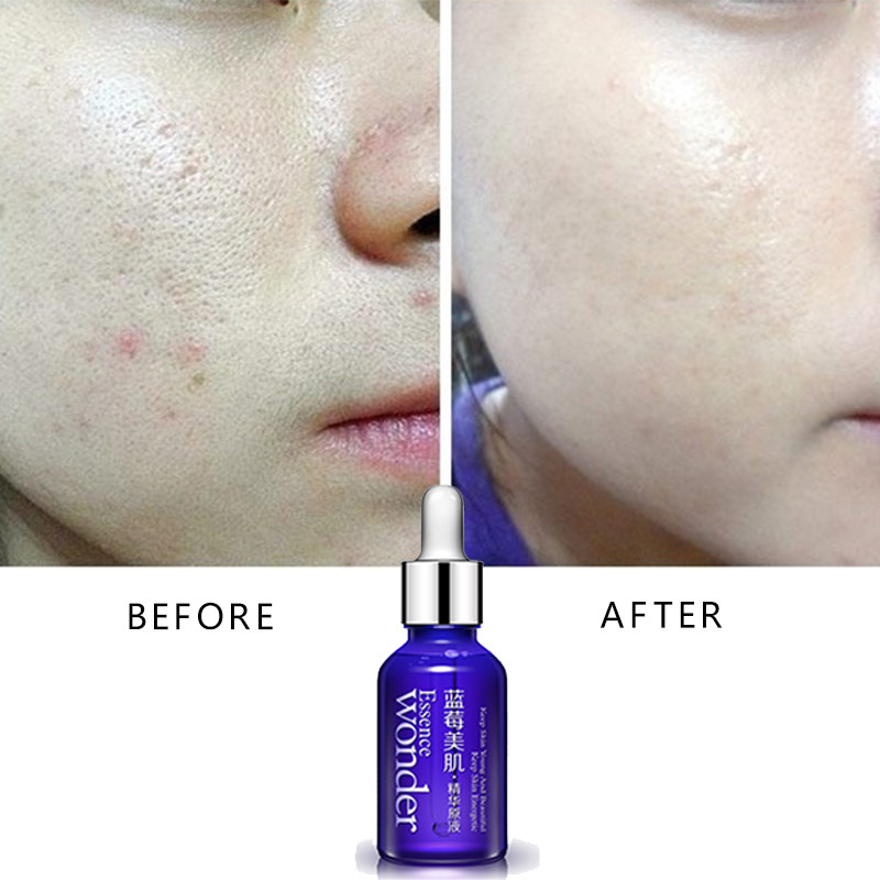 BIOAQUA Blueberry Face Lifting - огляд і ціна Skincare Garnier