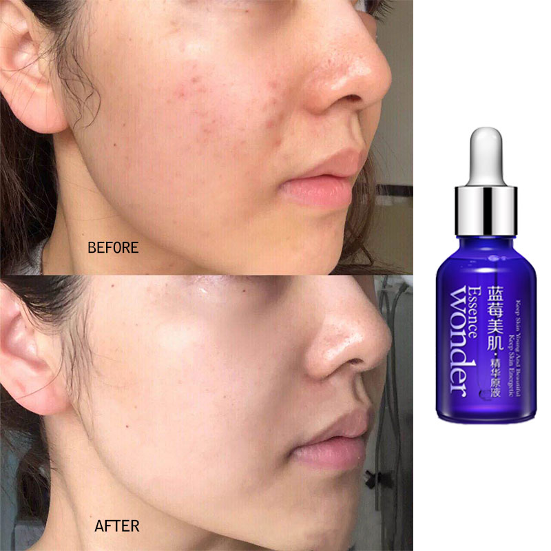 BIOAQUA Blueberry Face Lifting - огляд і ціна Skincare Garnier
