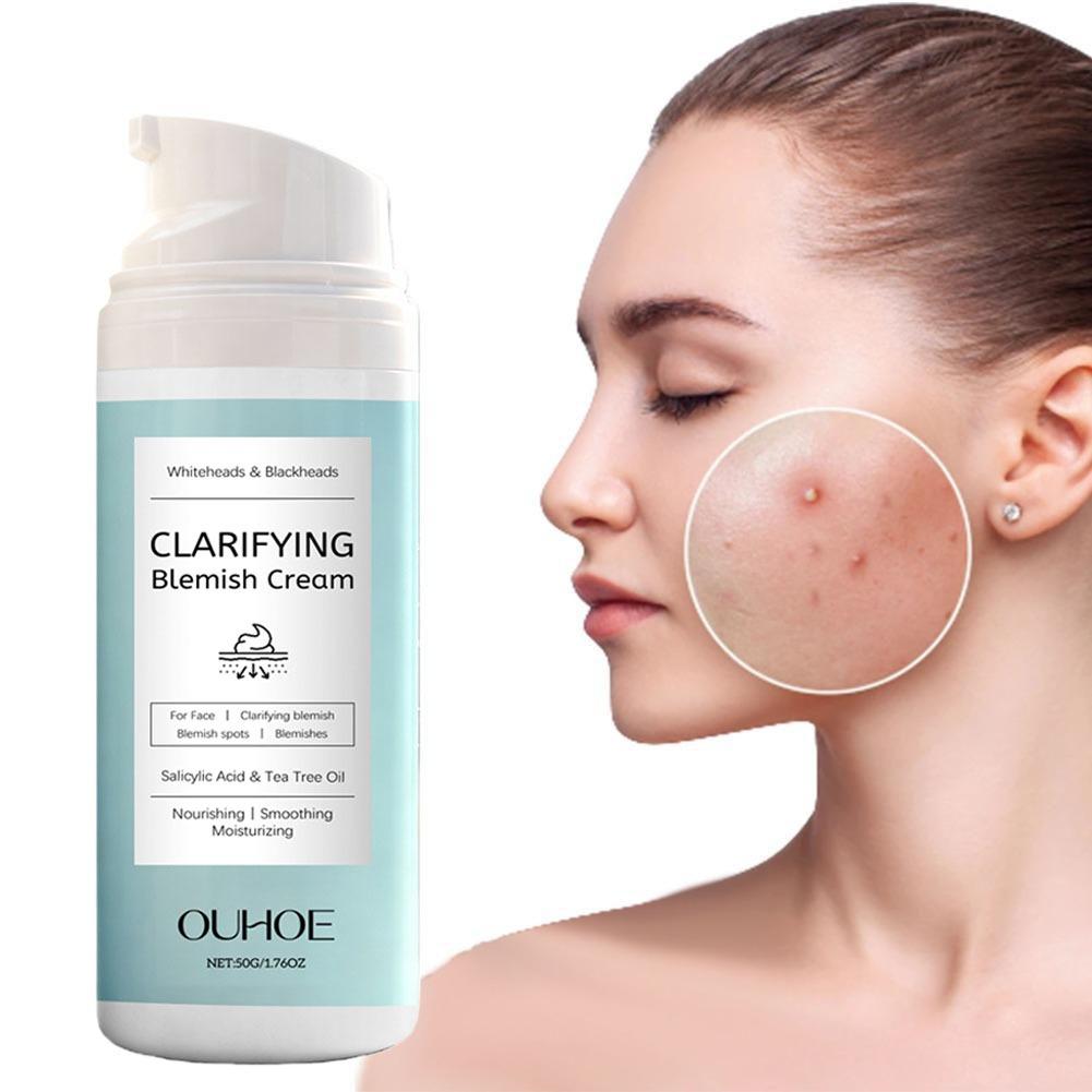 Salicylic Acid Facial Cream fo - огляд і ціна Azelaic Acid Cream