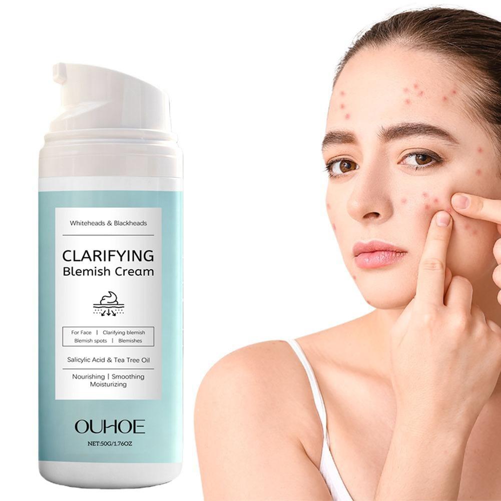 Salicylic Acid Facial Cream fo - огляд і ціна Azelaic Acid Cream