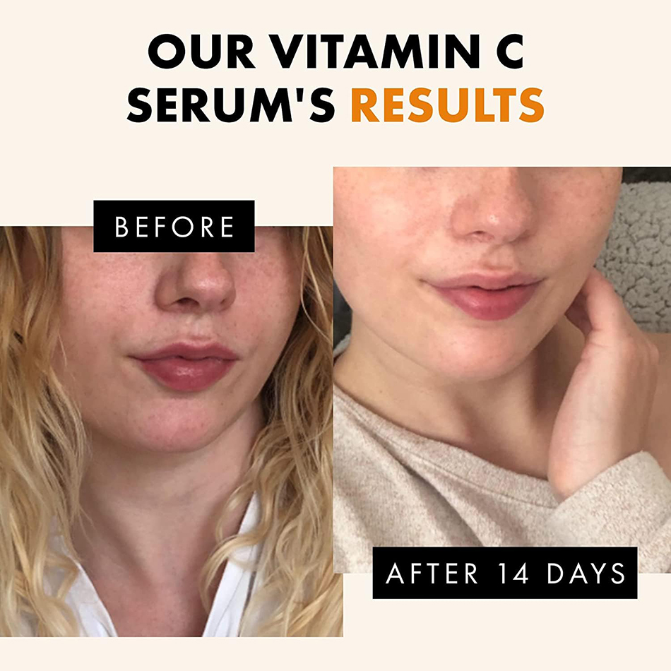 120ml 99% Vitamin C Serum Oil  - огляд і ціна Skincare Garnier