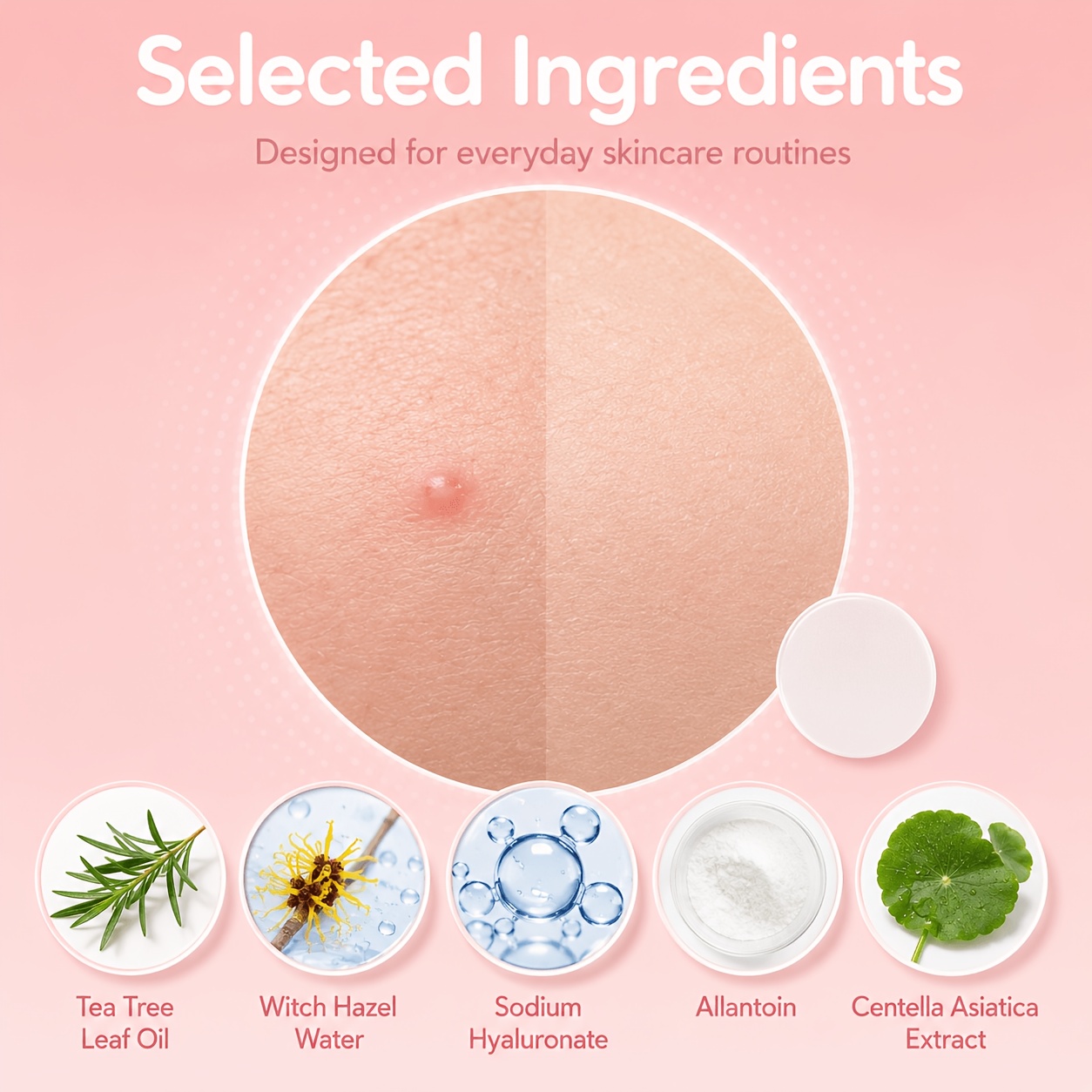 240/480/720pcs Hydrocolloid Bl - огляд і ціна Tea Tree Spot Treatment