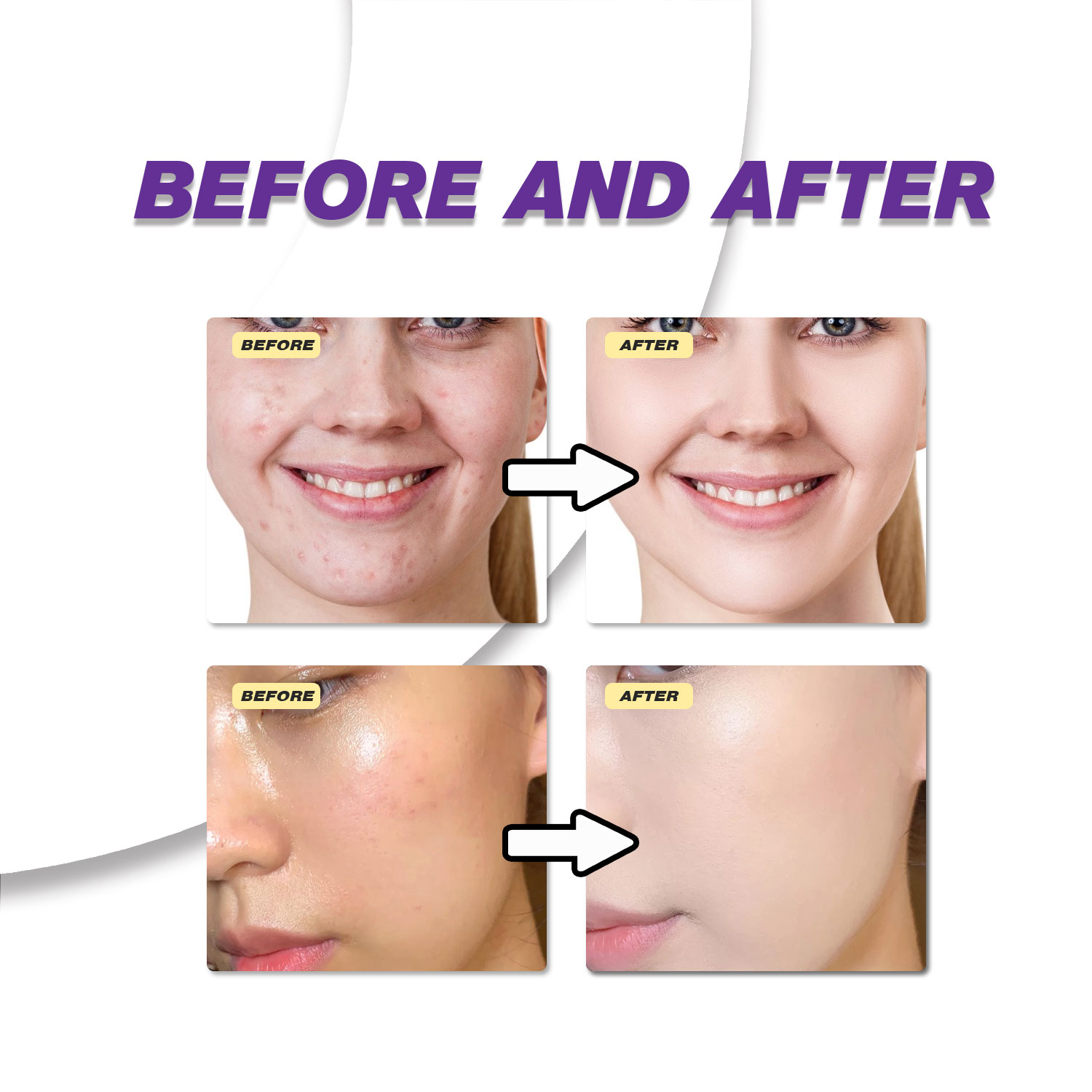 Mild Azelaic Acid Cream Improv - огляд і ціна Azelaic Acid Cream