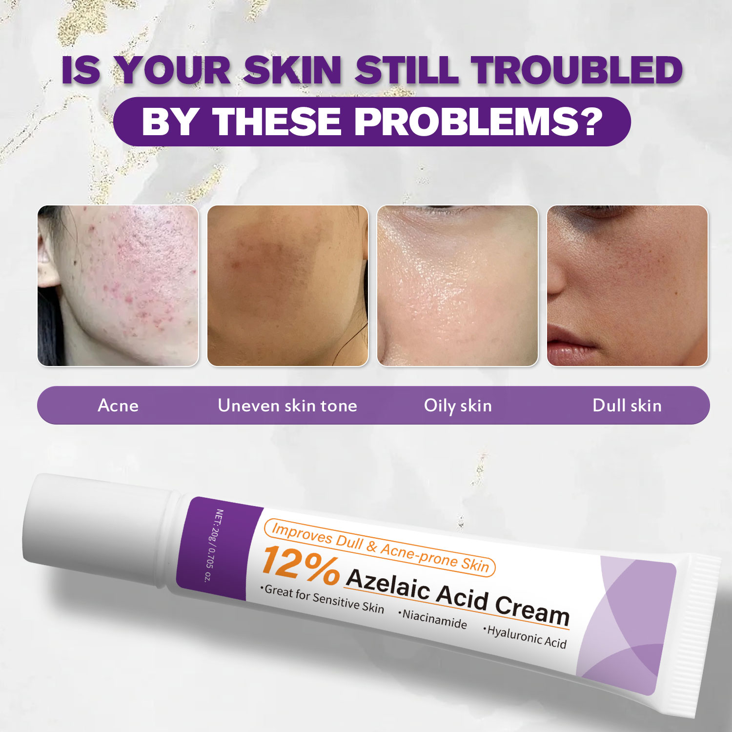 Mild Azelaic Acid Cream Improv - огляд і ціна Azelaic Acid Cream