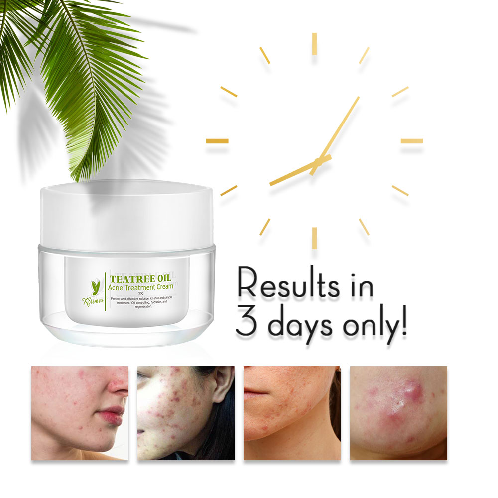 KStims Natural Acne Treatment  - огляд і ціна Tea Tree Spot Treatment